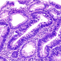 Does It Matter Who Is The Doctor Who Performs Screening Colonoscopy?