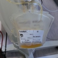 Why Some Ebola Patients Bleed, And How Plasma Might Help Recovery