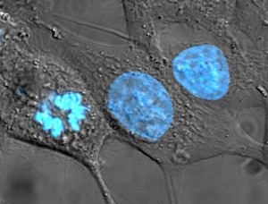Henrietta’s Cells Speak