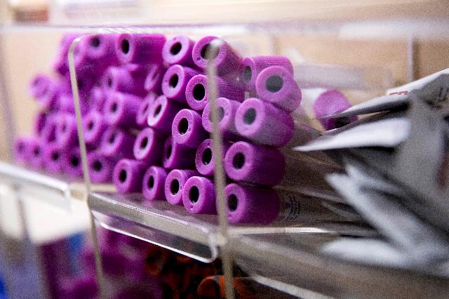 A Perfect Blood Test For Pancreatic Cancer?