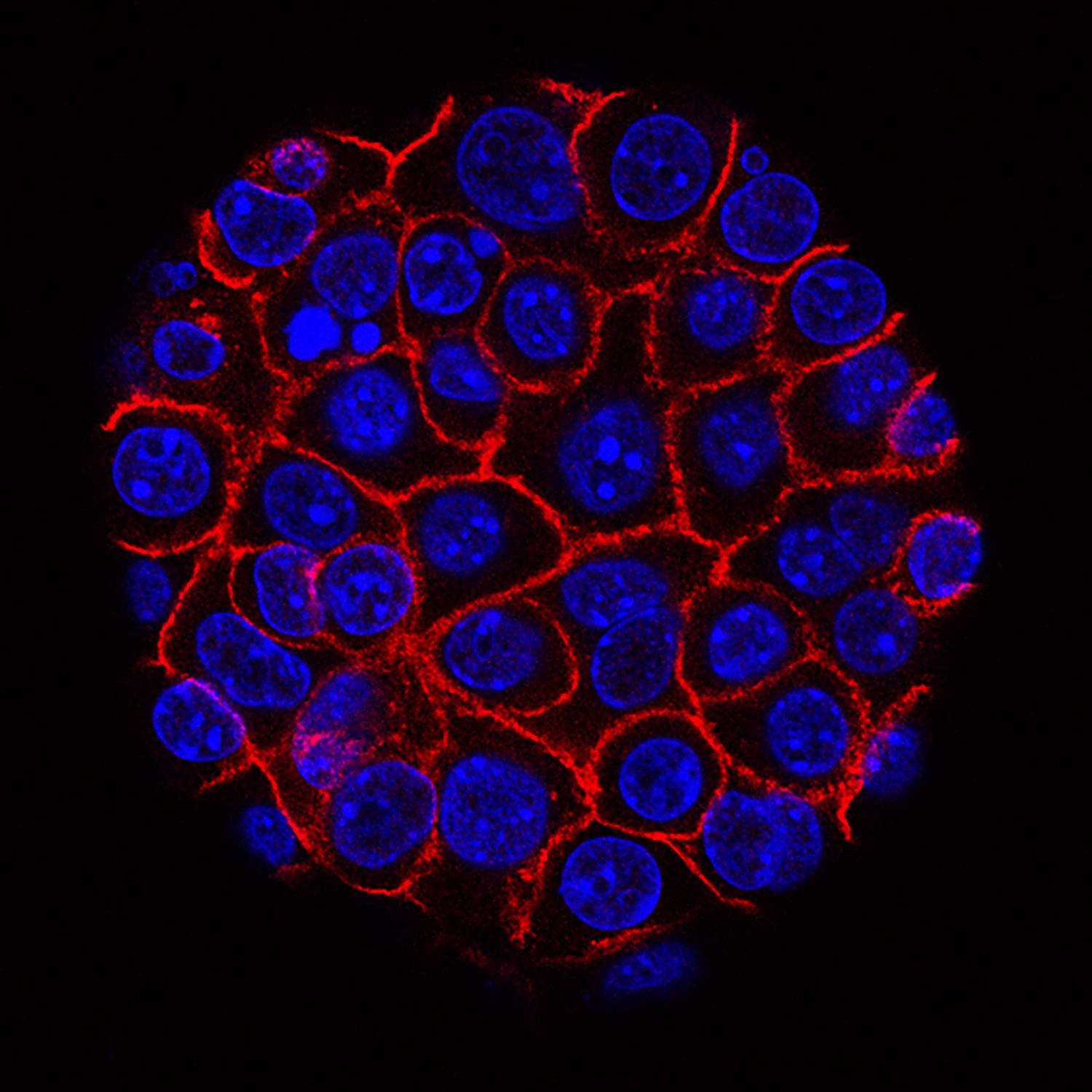 A Pill Might Control Pancreatic Cancer, Even If It Doesn’t Cure It